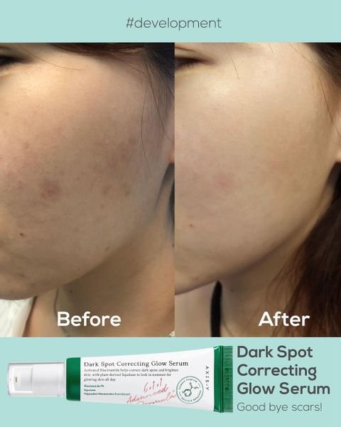 AXIS-Y DARK SPOT CORRECTING GLOW SERUM 50ml