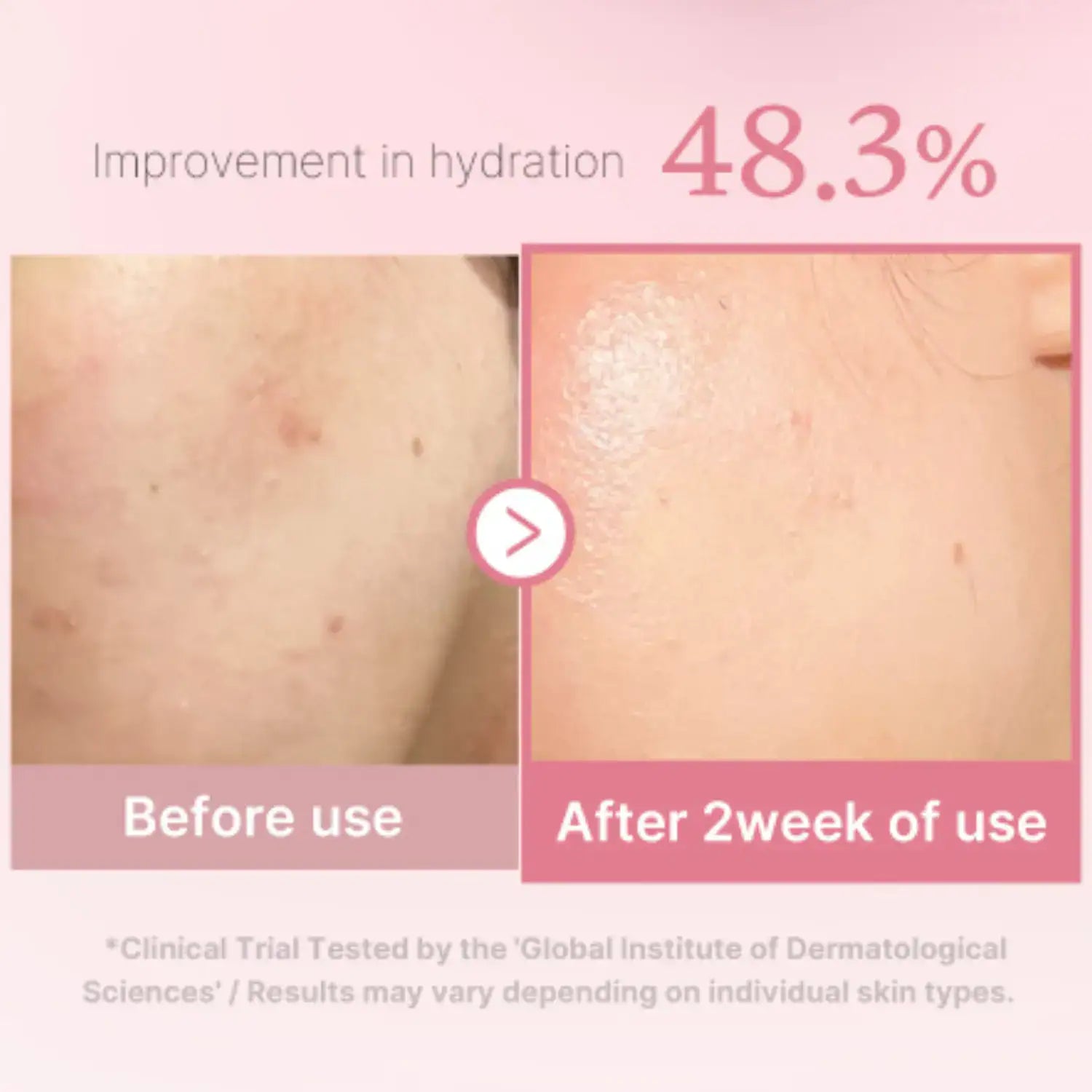 medicube - PDRN Pink Niacinamide Milky Toner 150ml